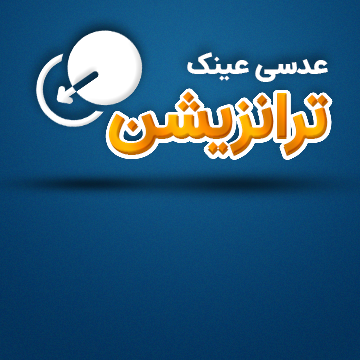 عدسی ترانزیشن